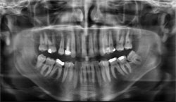 Digital Imaging Galway - OrthoPantoGram Digital Imaging Galway - OrthoPantoGram